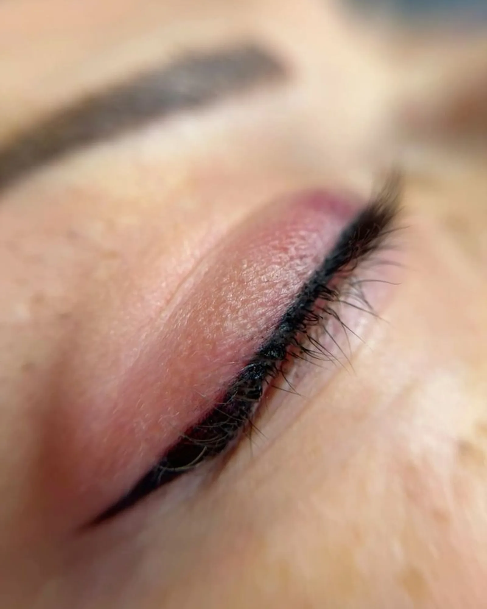 Infralash eyeliner, genezen resultaat